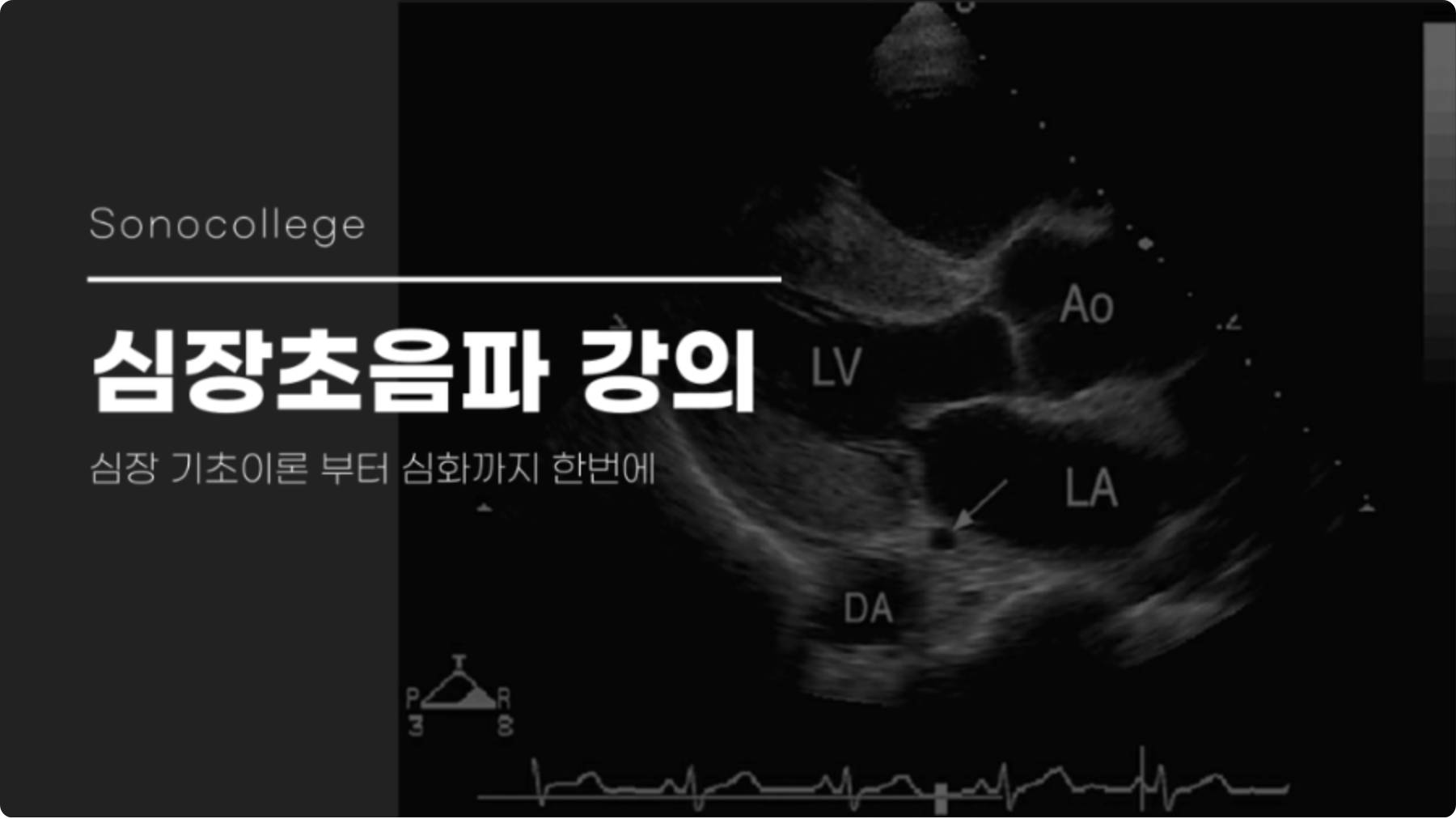 심장 초음파 강의