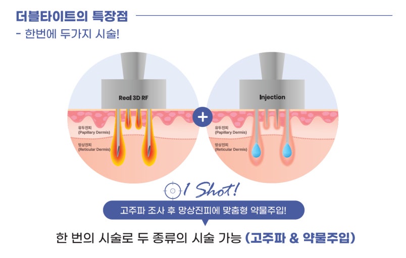 더블타이트