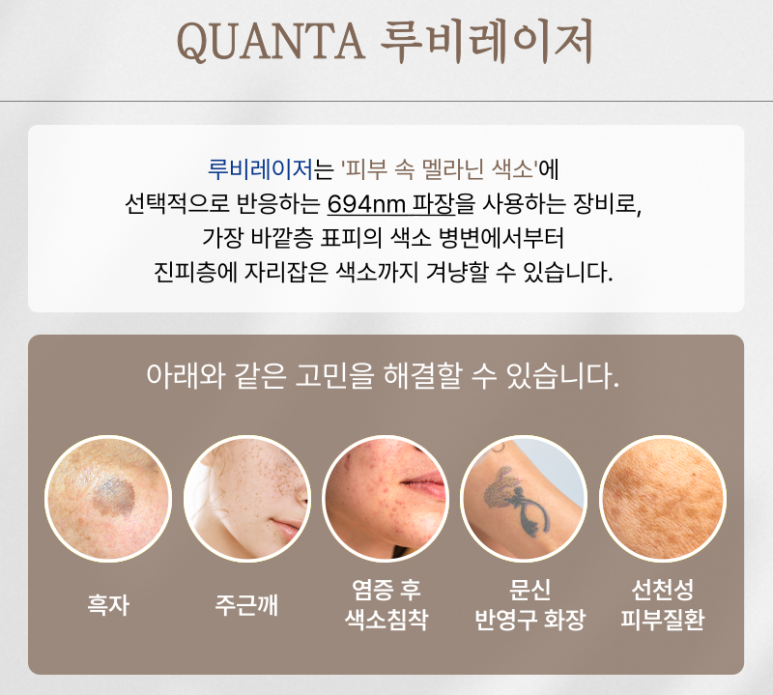 루비레이저
