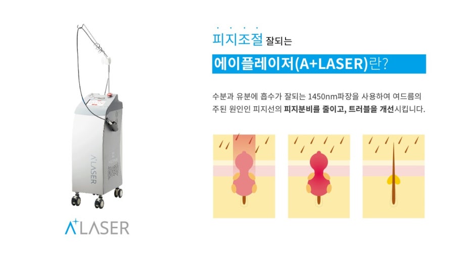 피지억제 레이저