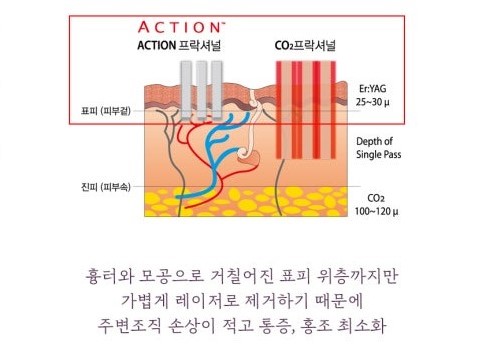 점