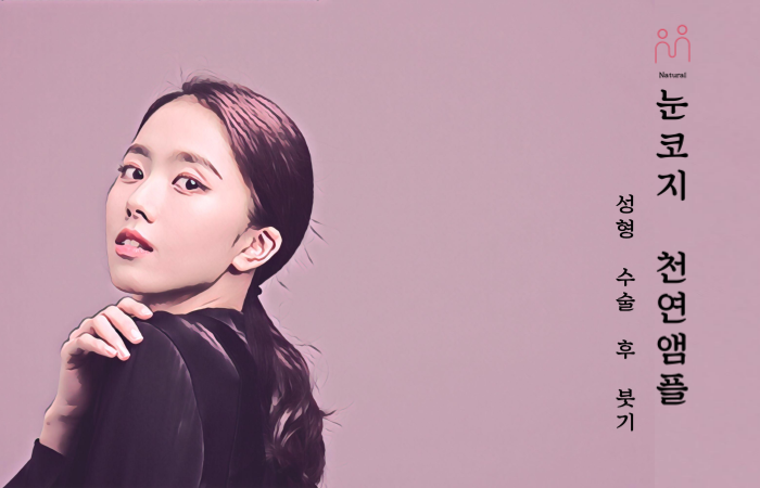 눈코지 천연앰플(성형 수술 후 붓기 관리)