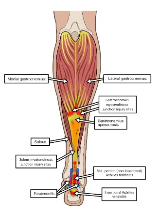c3a80e76-852d-487e-bc80-bf74b19b2db4