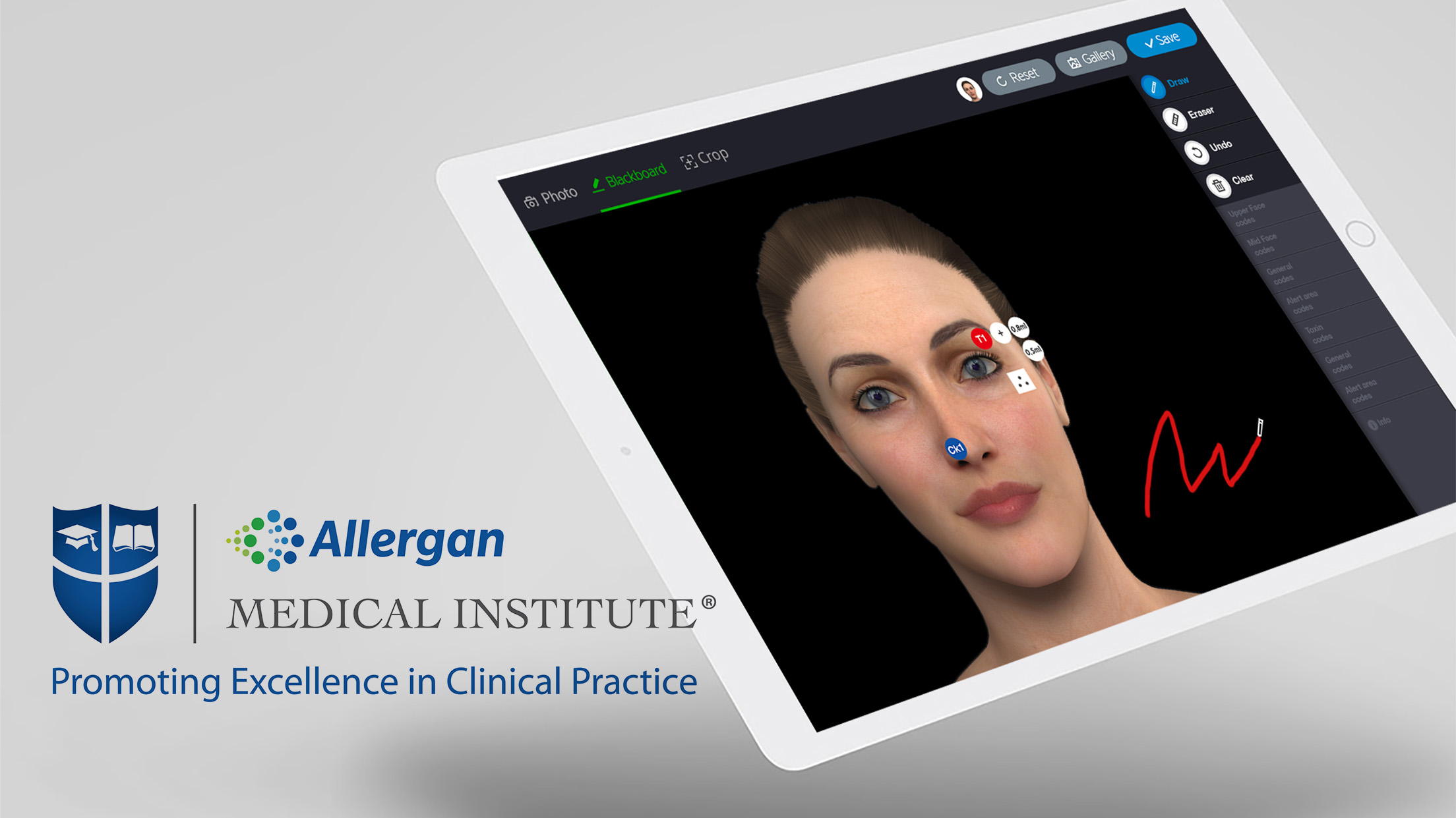 Allergan