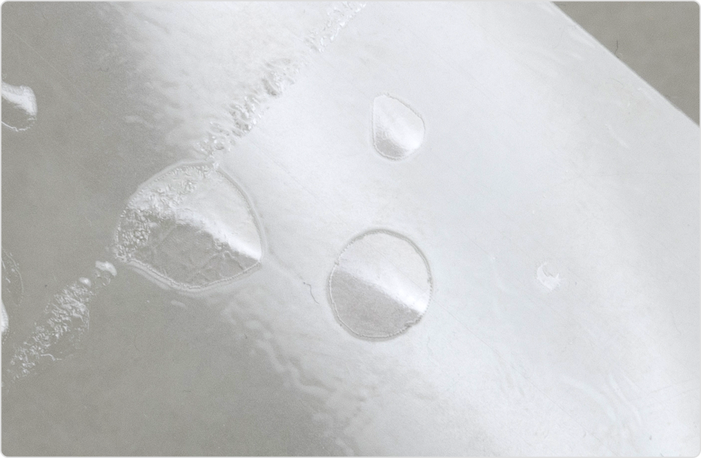 미세 잡티 안내