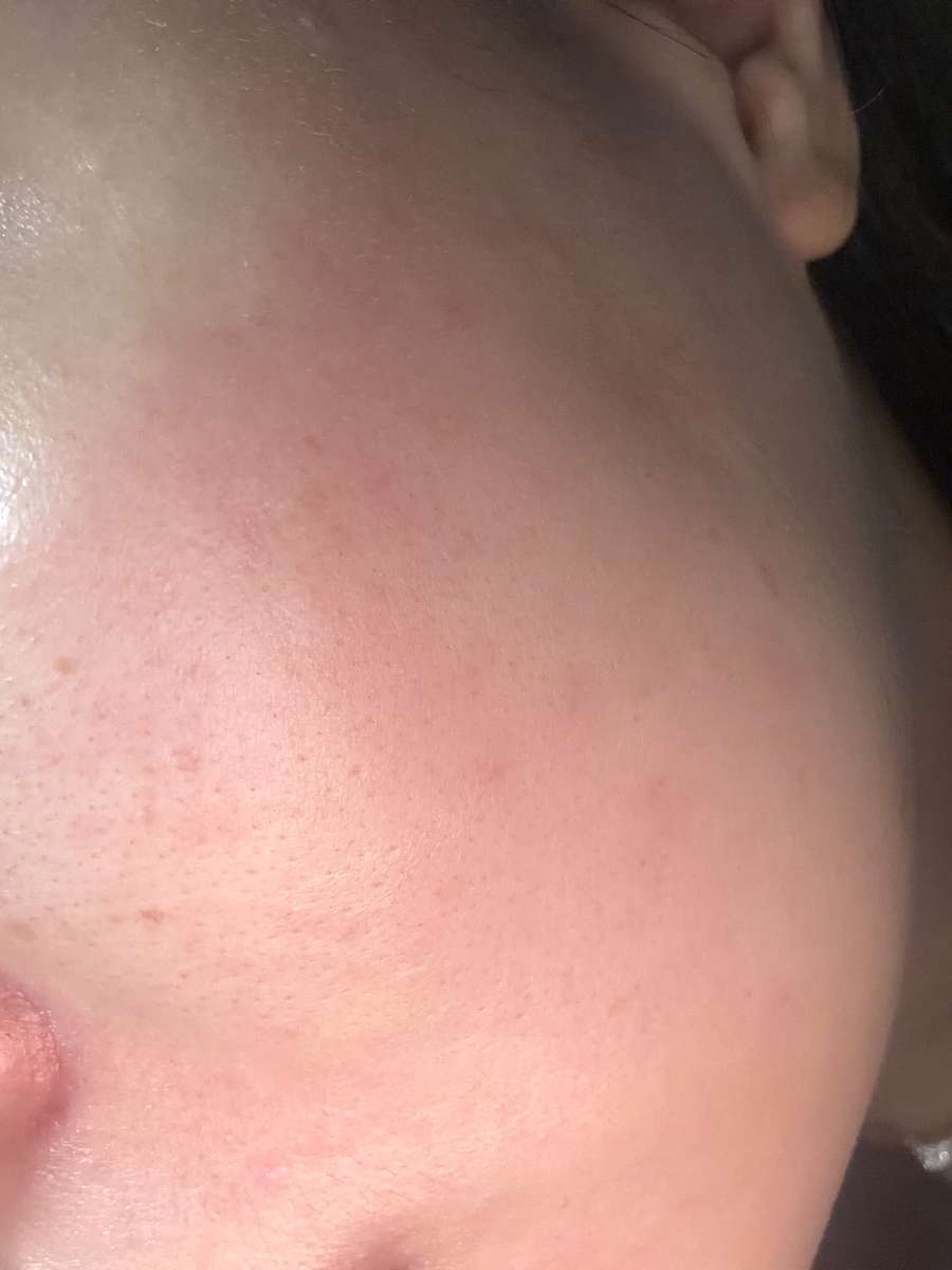 Customer review photo of the AROCELL Super Collagen Mask