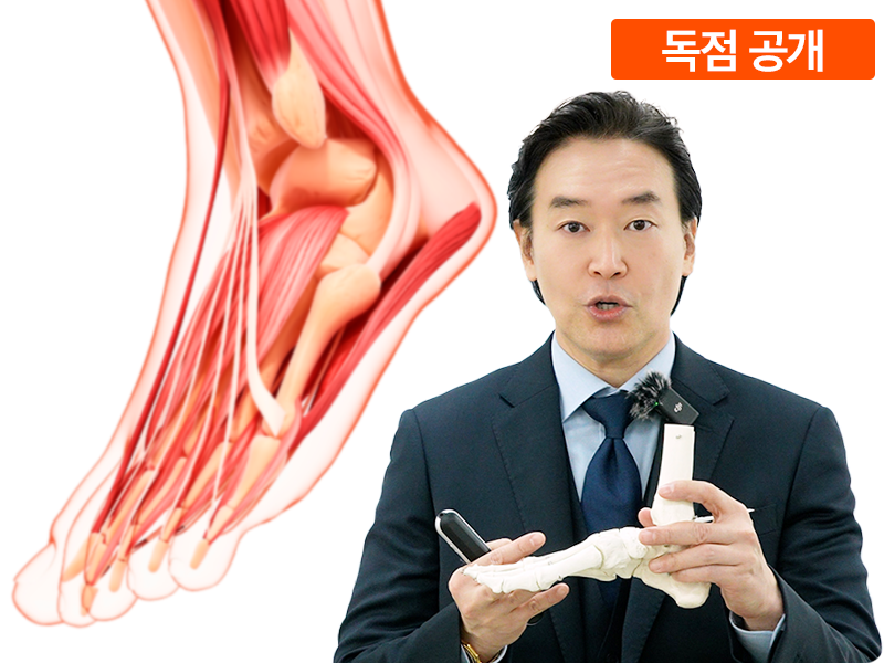 족부 변형 : 평발과 무지외반증_발의 과학편