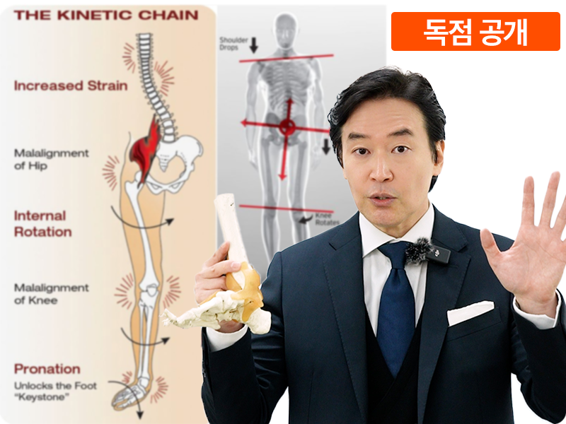 내 발 문제? _발 변형의 종류와 발생 원인편